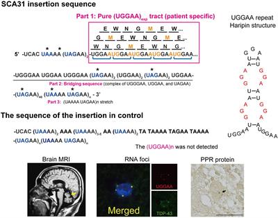 Insight Into Spinocerebellar Ataxia Type 31 (SCA31) From Drosophila Model